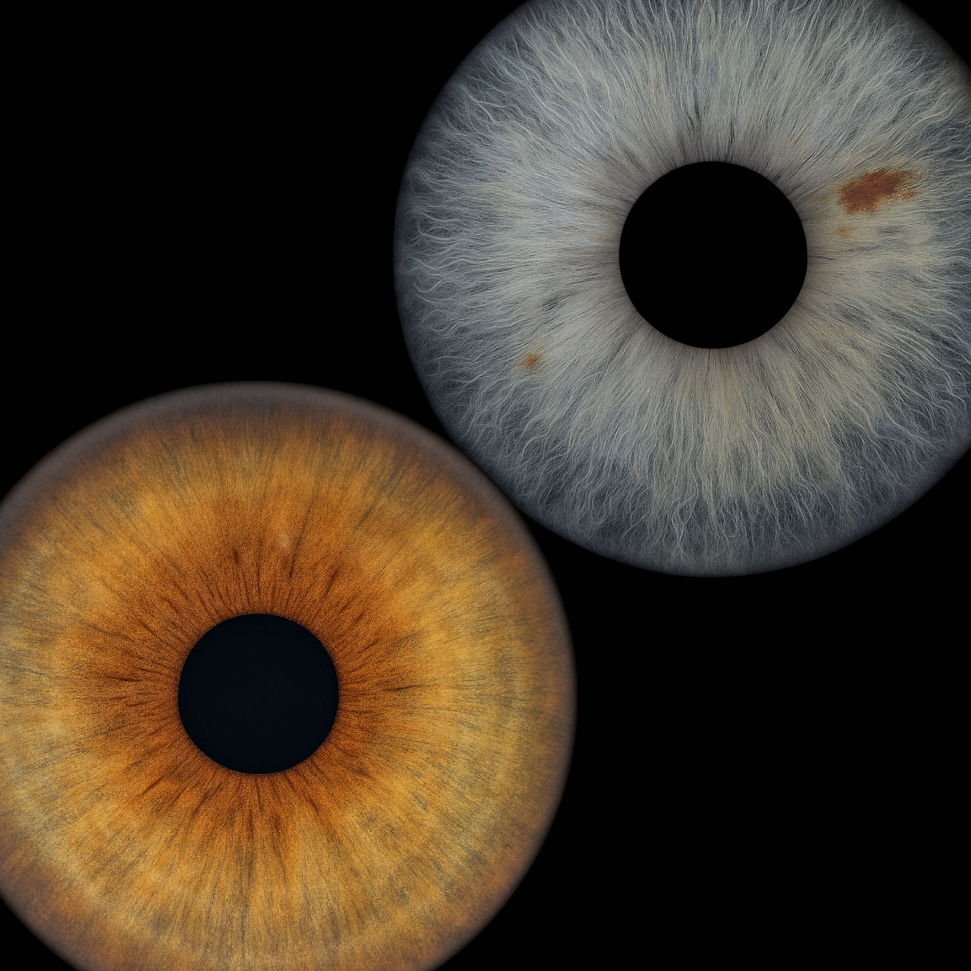 IRIDIA - REMOTE PACK