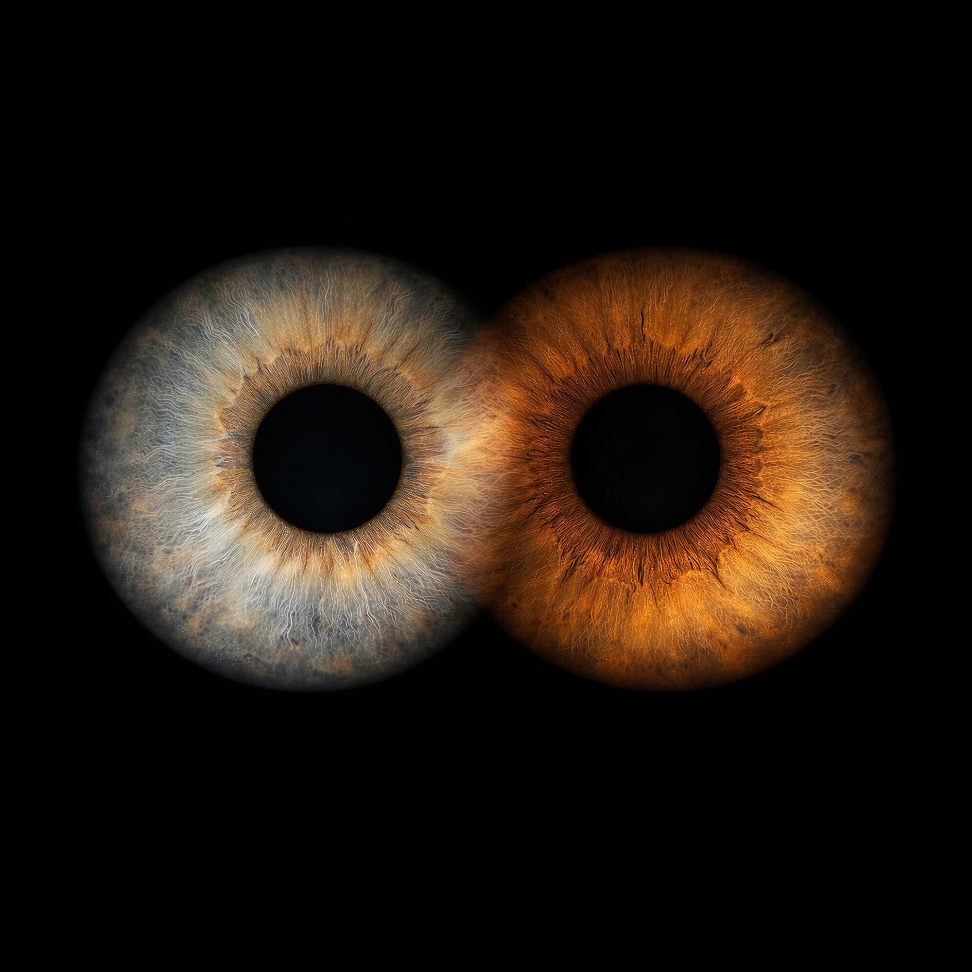 IRIDIA - REMOTE PACK